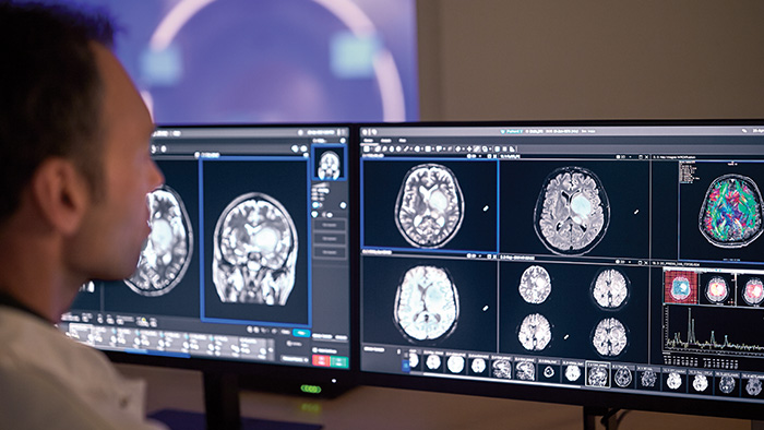 Controleren van beelden op dubbel scherm
