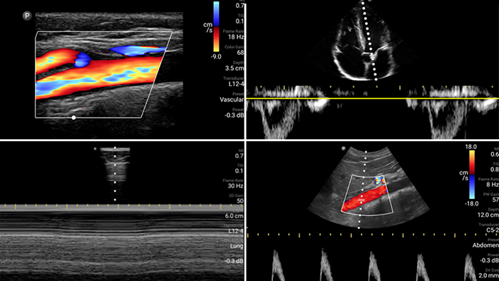 Eerste afbeelding casus