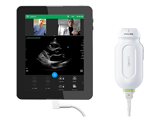 EPIQ echografiesysteem