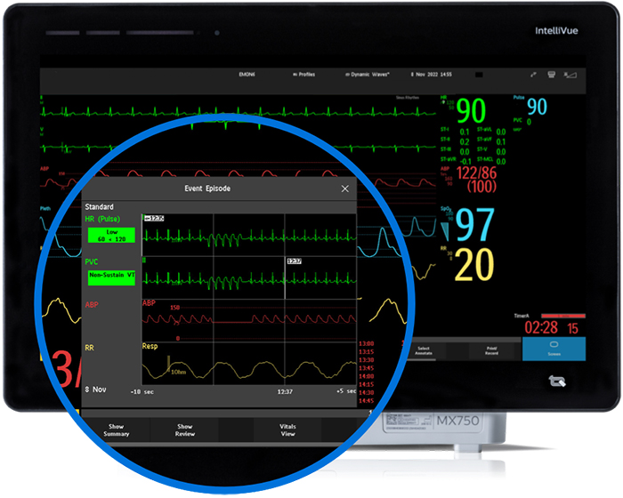 Geavanceerde voorvalbewakingsmonitor voor desktop